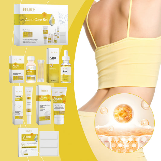 Acne Skin Care Set